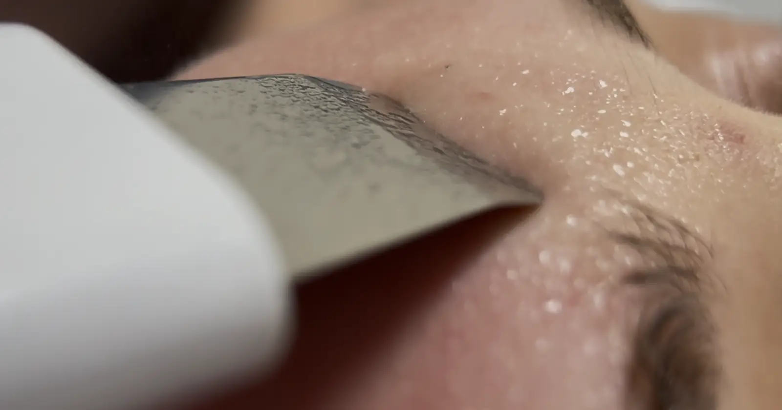 Peeling kawitacyjny wykonywany podczas profesjonalnego zabiegu kosmetologicznego